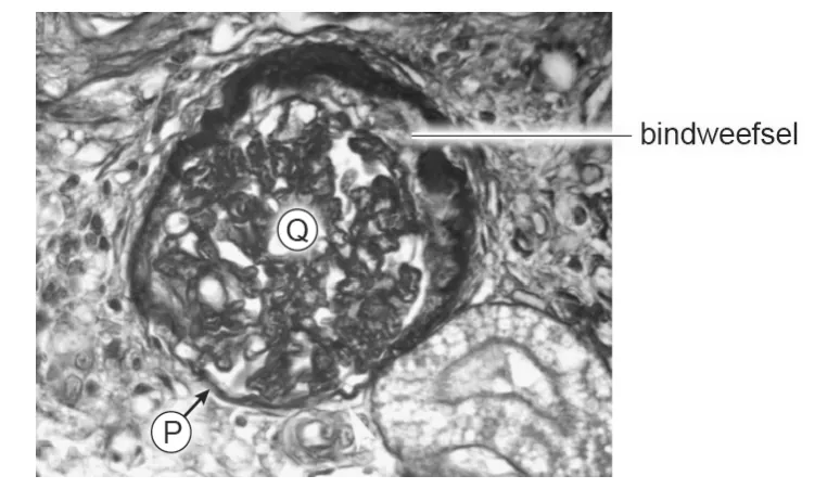 Microscopische foto van nierweefsel met een glomerulus, de letters P en Q en bindweefsel.